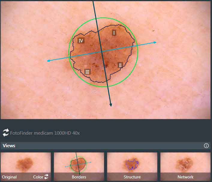 Diagnosetool Molanalyser Pro