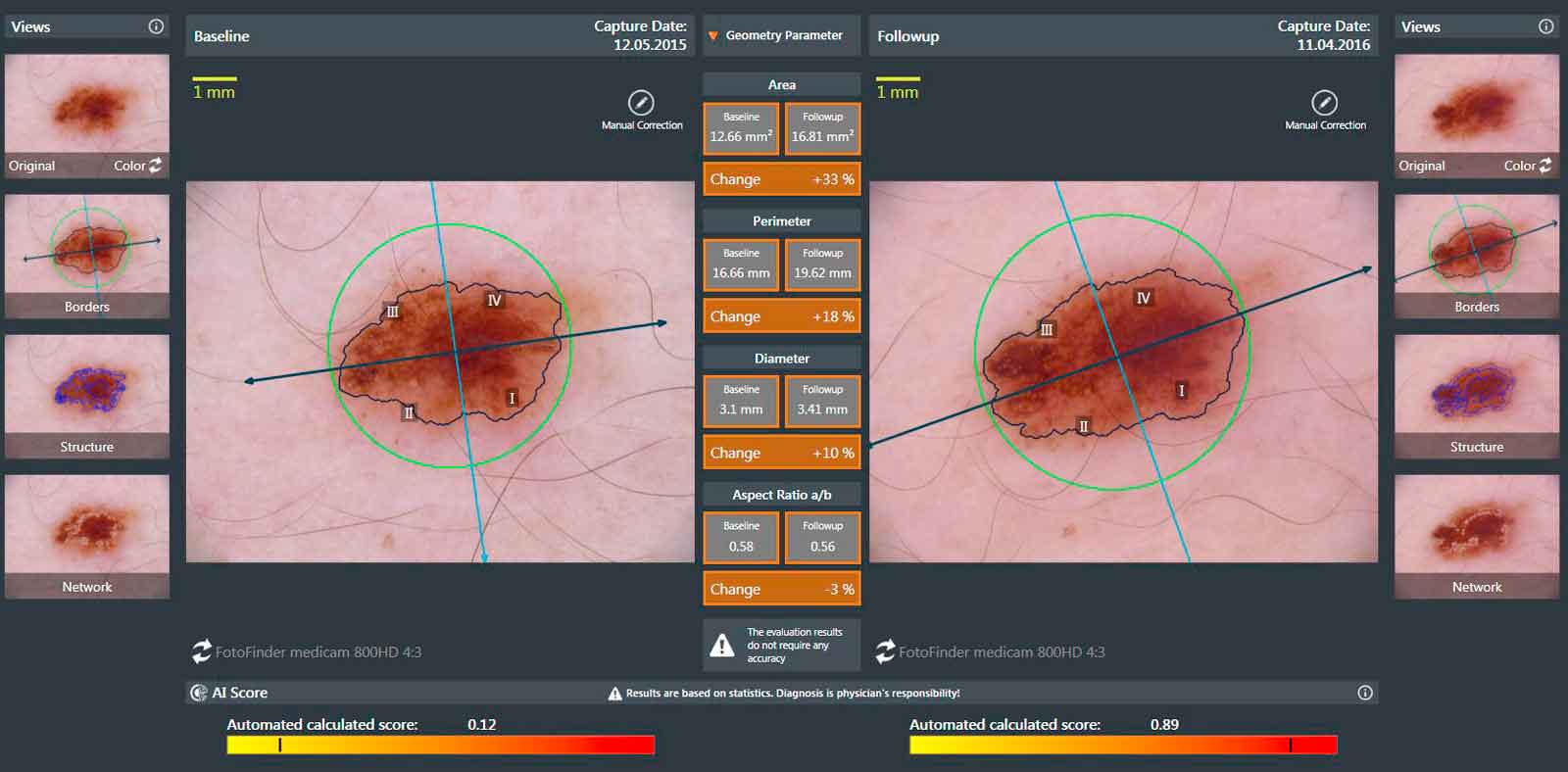 Diagnosetool Molanalyser Pro