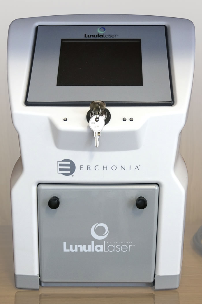 Lunula Onychomykoe Laser